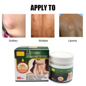 Chinese Medicine Multiple Anti-tumor Lipoma Pain Cream